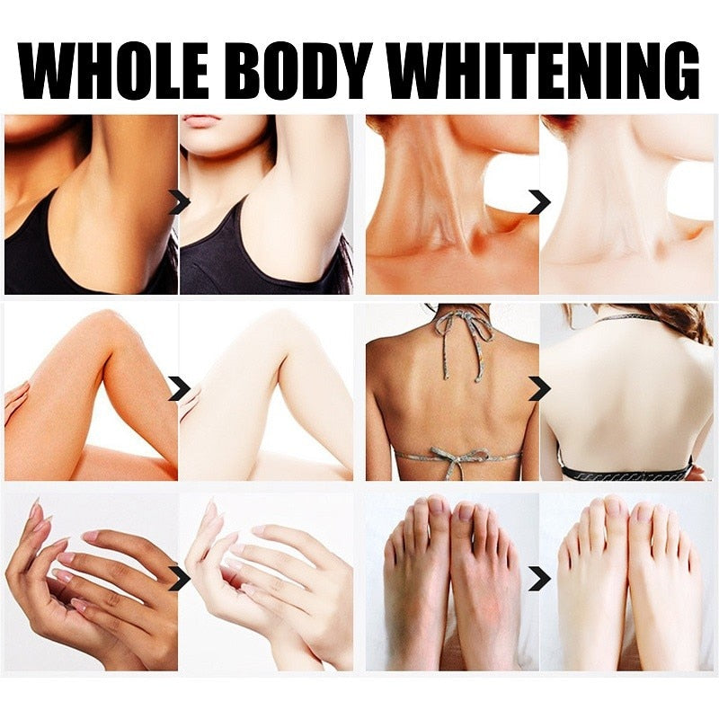 Body Whitening Cream Underarm Knee Buttocks Private Bleach Remove Melanin Pigmentation Improve Dull Nourish Brighten Skin Care